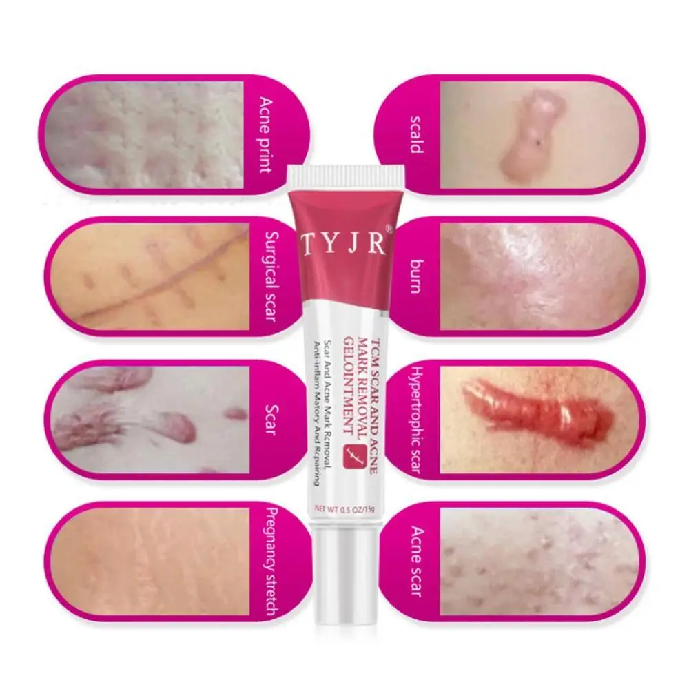 

TYJR Remove scar Acne Treatment Cream 15g Damaged Skin Repair Pregnant Woman Postpartum Care Face Whitening Care