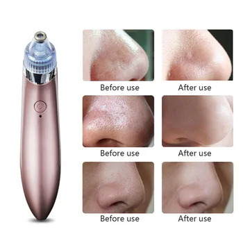 

Black Spot Cleaner Facial Cleansing USB Plug Cleaner Face Cleaning Blackhead Machine Acne Removal Face Professional Tools