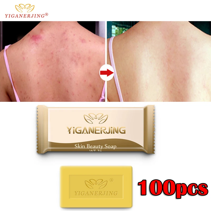 

7g Clean Skin Small Package Carry Sulfur Soap Skin Conditions Acne Psoriasis Seborrhea Eczema Anti Fungus Bath Whitening Soap