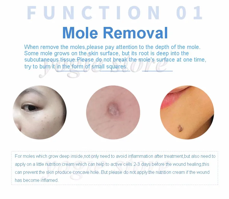 mole-removal-machine-6