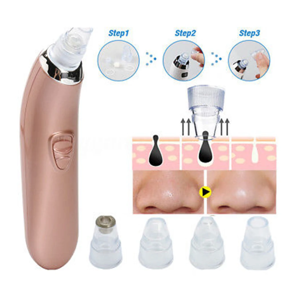 Electric Nose Pore Cleaner Deep Cleanser Facial Vacuum Blackhead Acne Remover 1PC High Quality