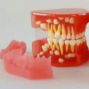 

Dental development 3-6 years old children's teeth development Model