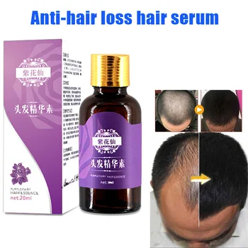 

Hair Care Essence Prevention Hair Loss Effective Growth Nourishes Oil Control H7JP