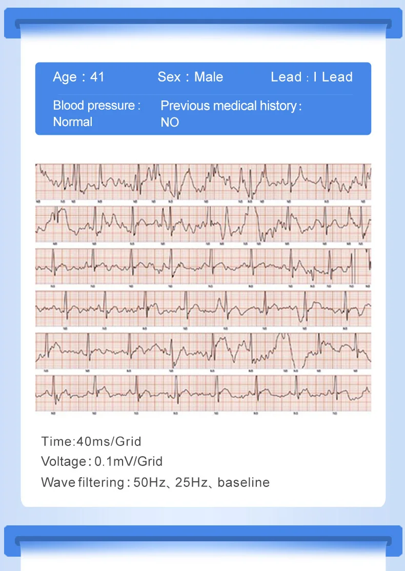 ECG+ PPG умный Браслет P3 plus кровяное давление и пульсометр шагомер спортивный браслет для IOS Android IP67 водонепроницаемый