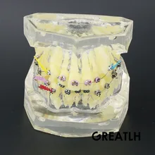 Стоматологическая прозрачная Ортодонтическая модель лечения зубов исследование/Обучение Модель#3005 02