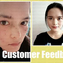 2 шт. набор красок моль бородавки удаление черные пятна брызги Remover