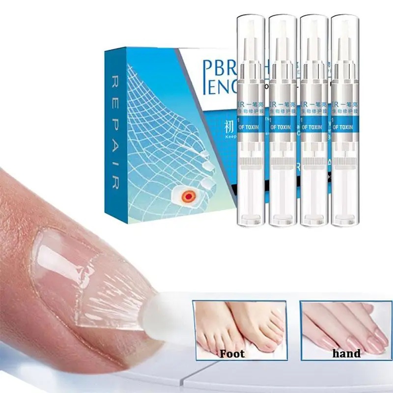 Toenail Fungus Treatment Toenail Antifungal Care Nail Fungus Treatment Pen Fungal Nail Gel
