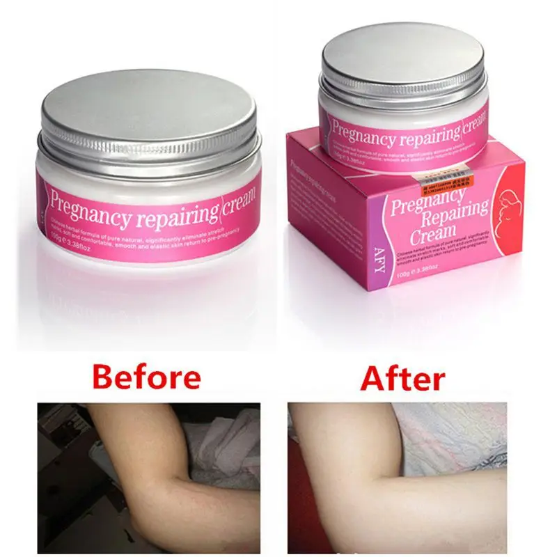 Stretch Mark Pregnancy Mark Repairing and Remove Scar Firming Creams