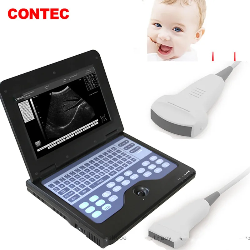 

CONTEC Human Use Machine with 2 probes Convex+Cardiac