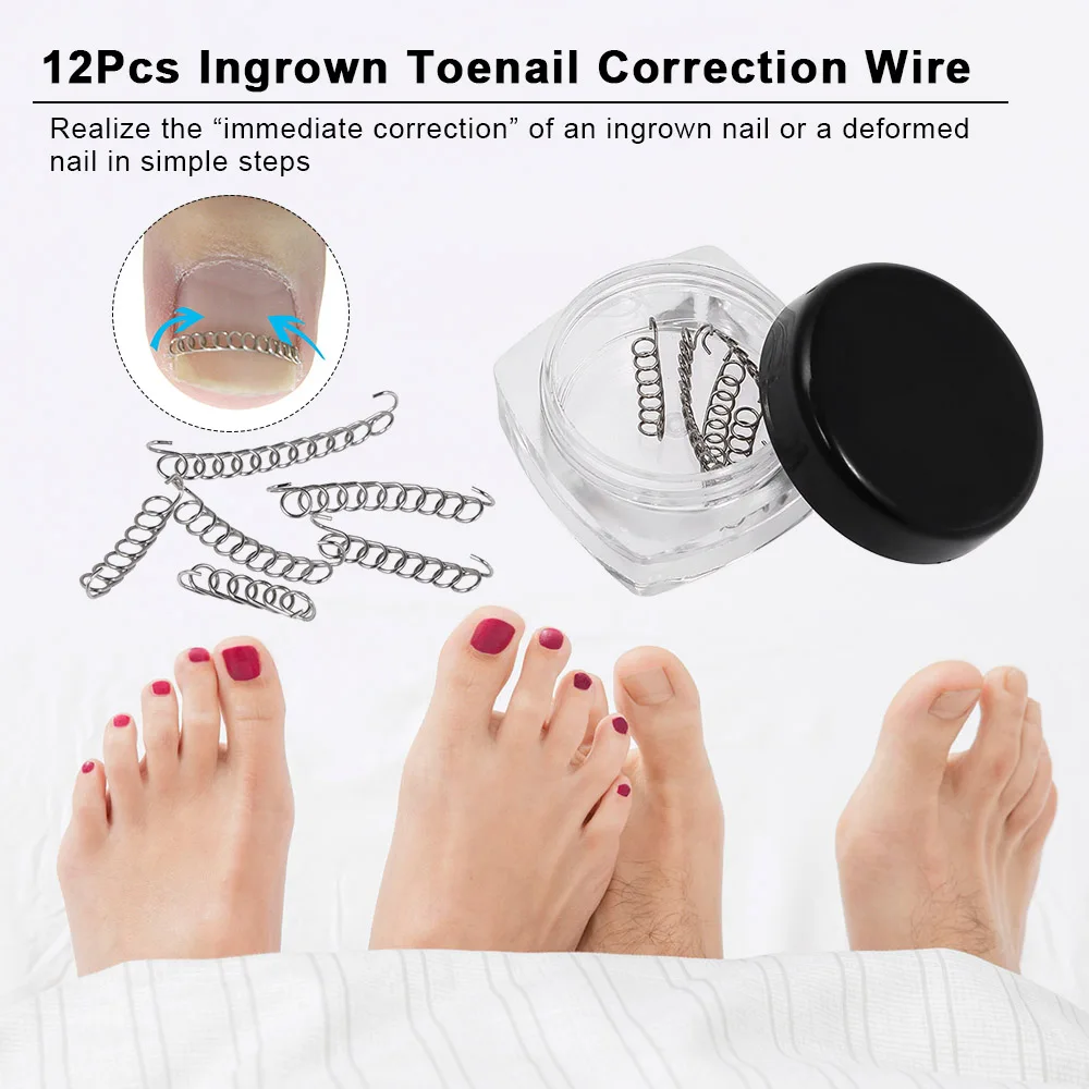 

12Pcs Fixer Pedicure Recover Ingrown Toenail Correction Wire Fixer Toenail Corrector Ingrown Toe Nail Foot Care Pedicure Tool