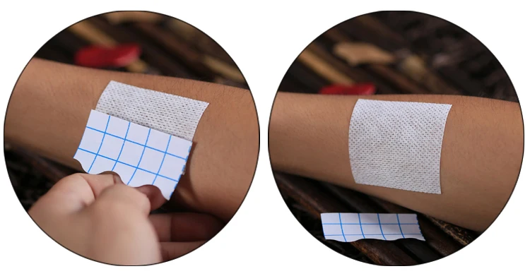 100 pcslot Medical Non-woven Tape Breathable Anti-allergic Medicinal Wound Dressing Fixation Tape Drug Patches Adhesive Plaster (10)