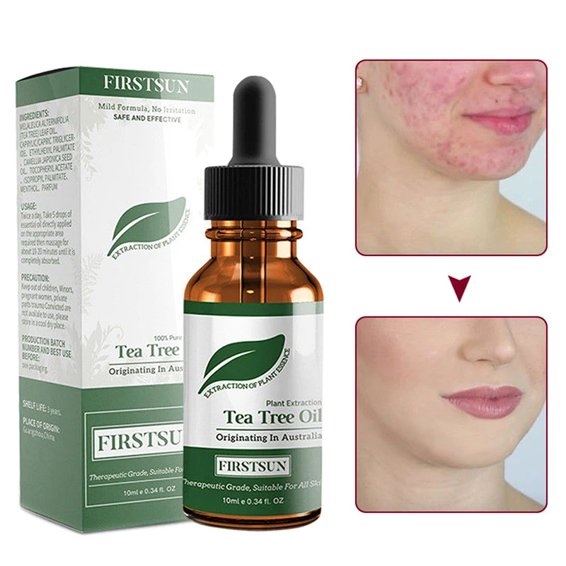 

1pc Tea Tree Essential Oil Facial Massage Care Shrink Pores Acne Removal Oil Control Face Care 10ml