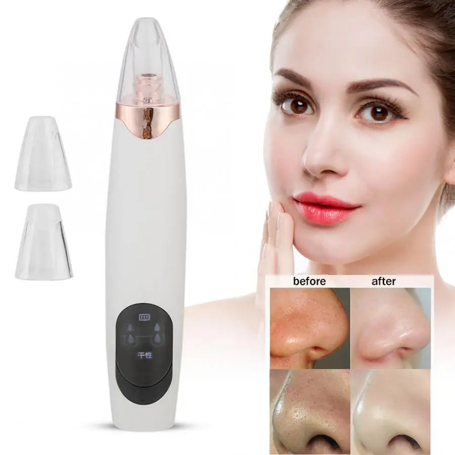 Electronic Face Pore Cleaner Blackhead Removal Suction Machine Beauty Device s
