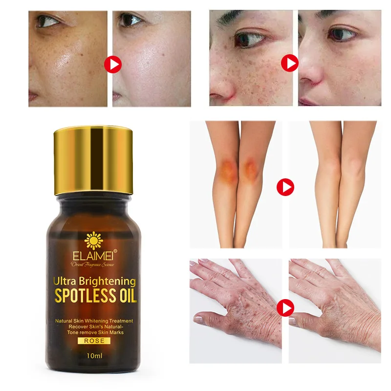 10ml Brightening Spotless Rose Essential Oil Skin Care Natural Pure