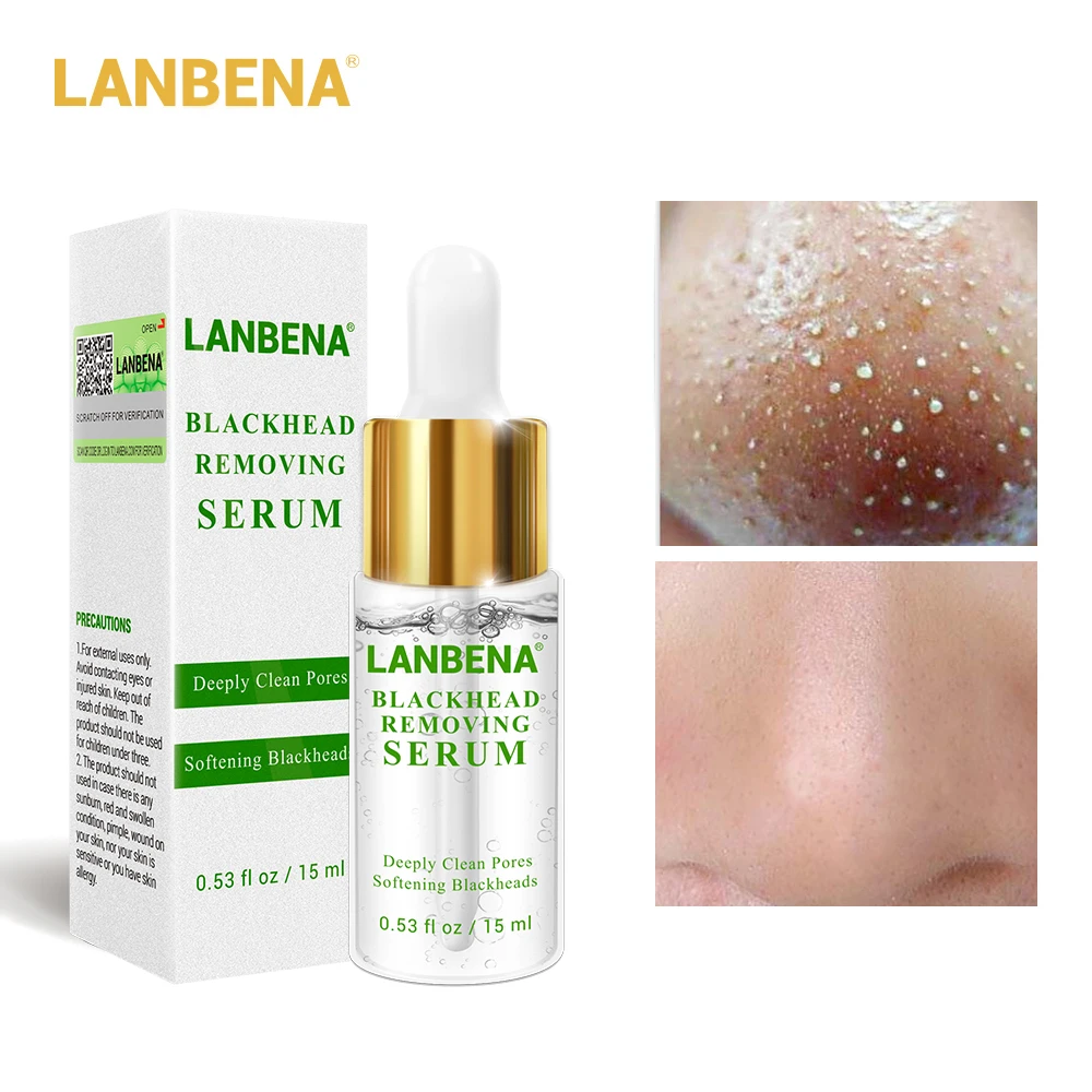 the ordinary skincare for blackheads