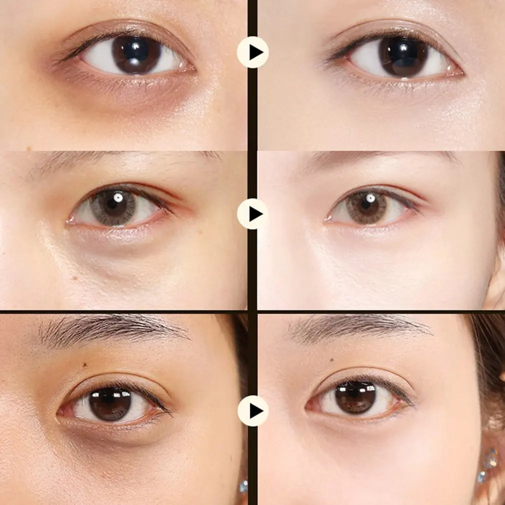 Black Pearl Lady Eye Mask Crystal Gel To Eye Bag Black Circles Lightening Fine Line Firming Skin Eye Mask