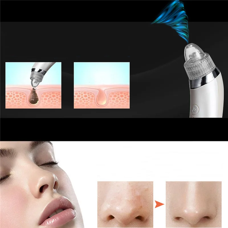 Máquina de Sucção a Vácuo Dispositivo de Massagem Removedor de Pele Morta da Pele Facial Elétrica Utiliza Pore Cleaner Cravo Acne Massagem Limpo 23 Máquina de sucção A Vácuo Dispositivo de