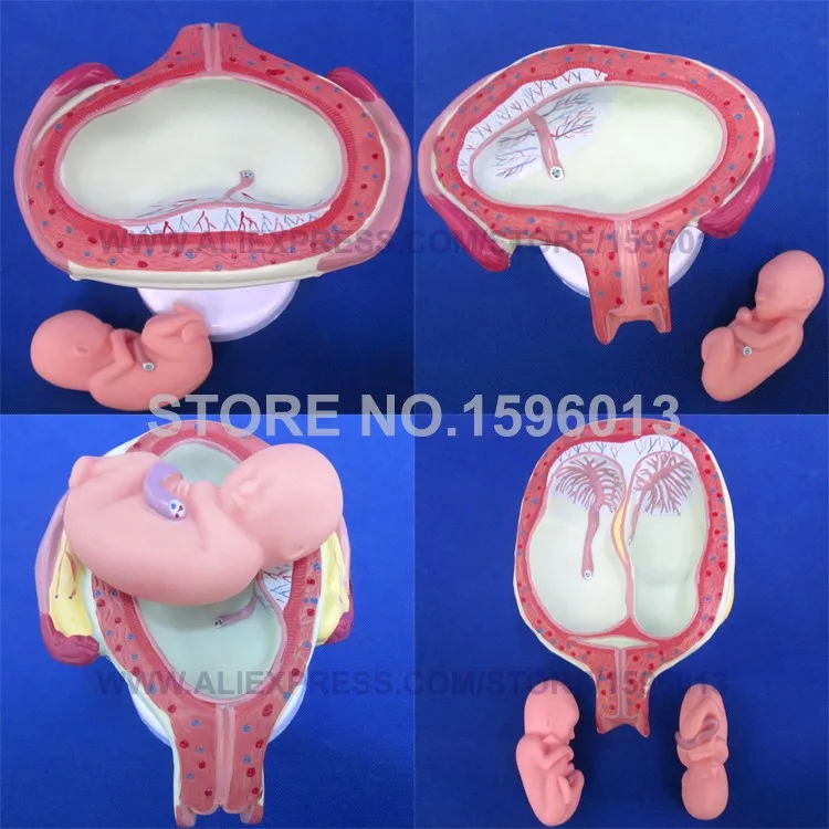 Модель развития плода, модель развития эмбриона, анатомическая матка и плод с пупочным шнуром, модель развития плода