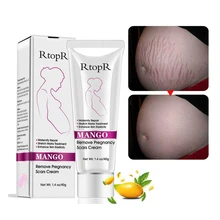 Горячая 40 г удалить беременность шрамы крем от акне лечение растяжек Mater