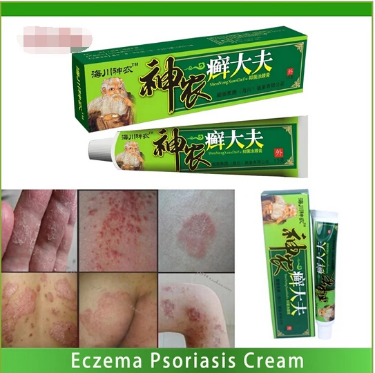 1pcs Cool Safety Chinese Ointment Psoriasis Tinea Versicolor Manuu ...