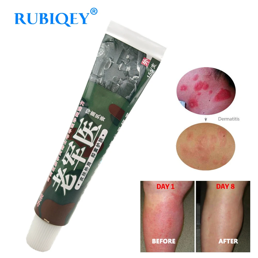 

Original Psoriasis Dermatitis Eczema Pruritus Skin Problems Cream With Retail Box Hot Selling RUBIQEY