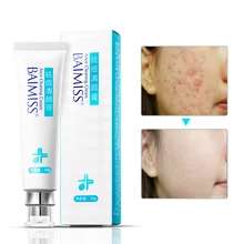 BAIMISS Acne Cleaning Cream Skin Care Remove Repair Comedone Pimple Acne Quickly Face Acne Cream Remover Anti Acne Treatment