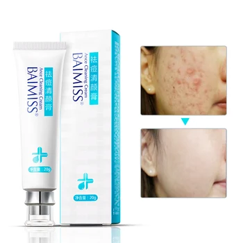 BAIMISS Cleaning Skin Care Repair Comedone Pimple Quickly Face Cream Acne Treatment
