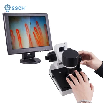 

NEW 600x Suyzeko GY-XW120 Portable Micro-Circulation Microscope