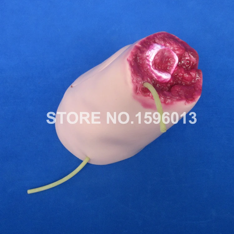 J108-2 amputation (5)