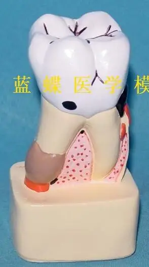 QQ20180623170252