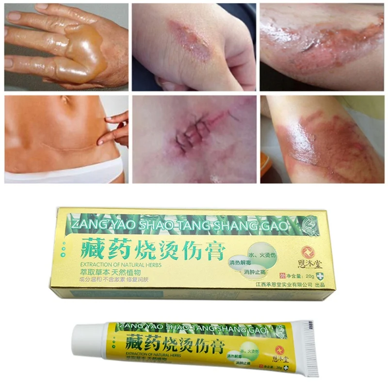 Мазь от ожогов Антибактериальная для лечения кожи Китайский травяной крем китайская медицина 20 г