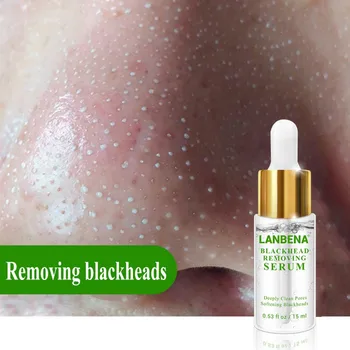 

Blackhead Removing Serum Deep Pore Acne Pimple Gentle removal Acne Treatment Shrink Pores Purifying Skin Care 15ml