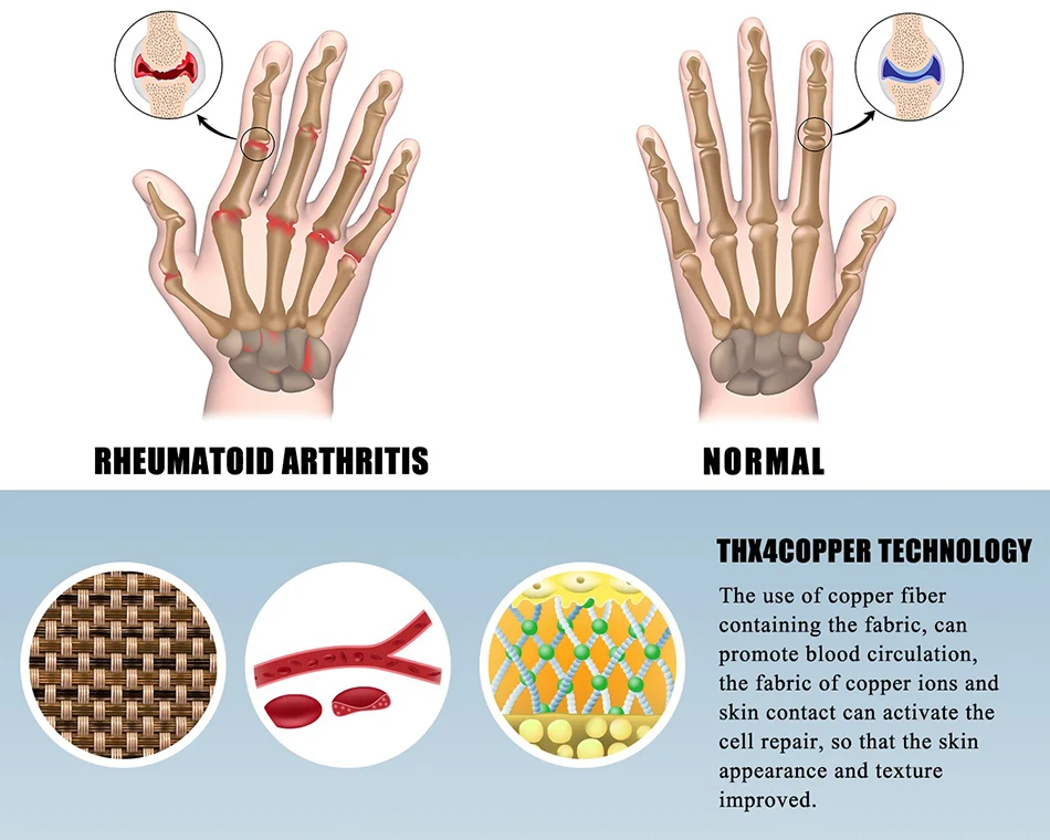 Cotton Compression Arthritis Gloves