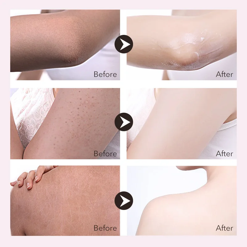  250ml Whitening Body Cream Moisturizing Body Lotion Deep Replenishment Lightening Cream for Body Lo
