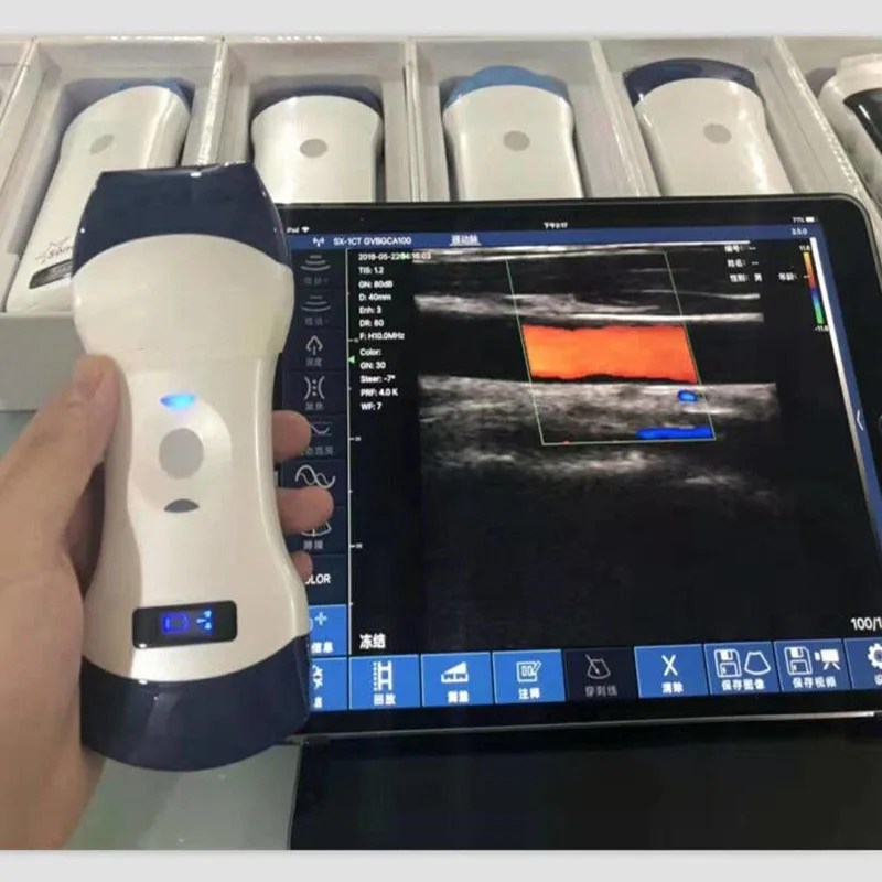 

PW color Double probe Wireless Veterinary Ultrasound Scanner Portable Pregnancy Test pig dog Hand Ultrasound Machine Pocket dog
