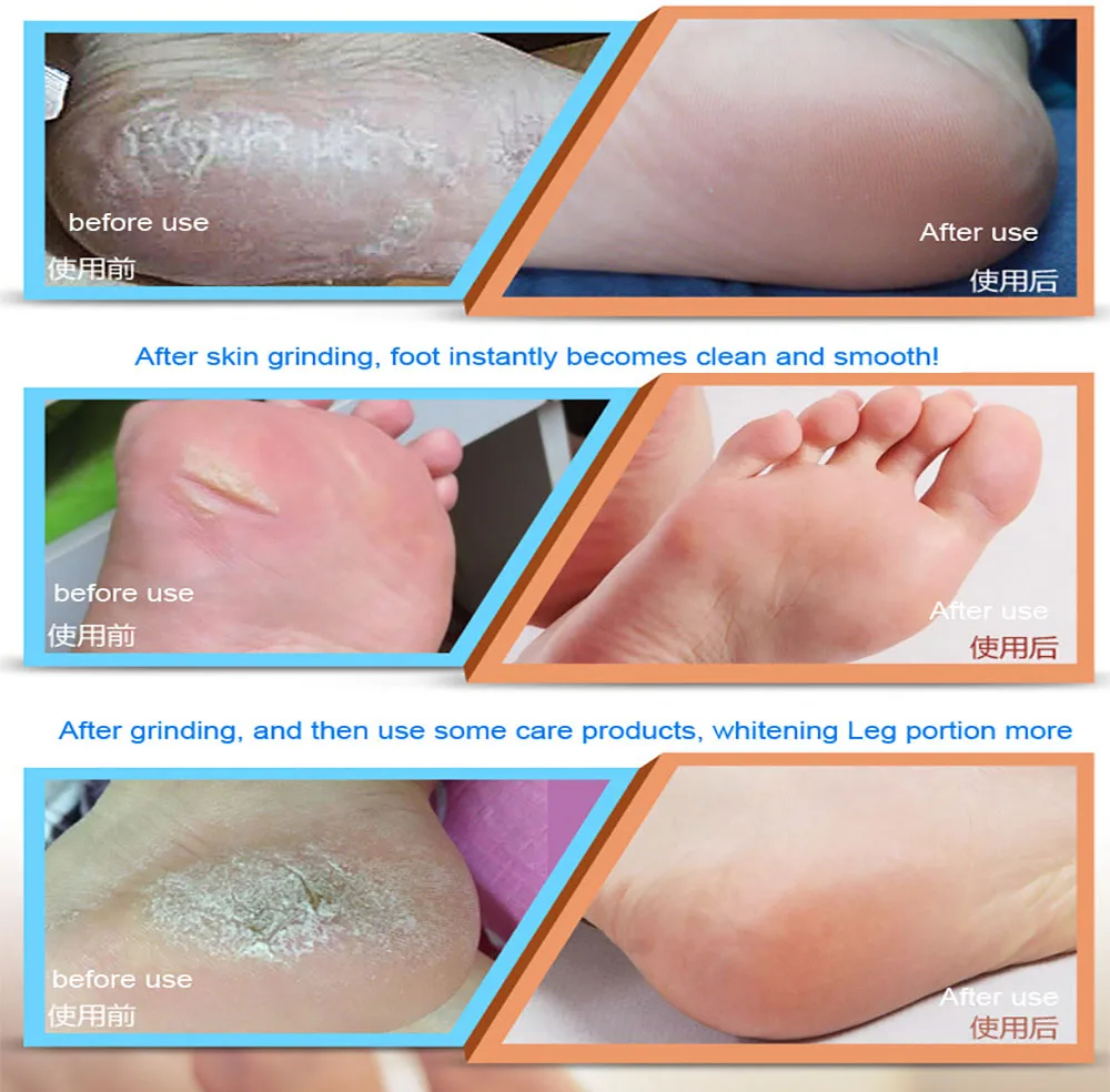 Ferramentas do Pedicure Cuidados com os Pés Ferramenta de Cuidados com os Pés Morta da Pele Pedicura e 7 Elétrico Remover Calos Ferramenta Pele pé Arquivo ps Rolos Cabeças Vermelhas de 32 Com Os Pés Ferramenta de Cuidados Com