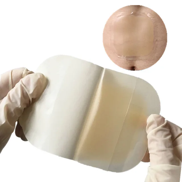 4" x 4" Sterile Hydrocolloid waterproof Wound Dressing for Ulcers