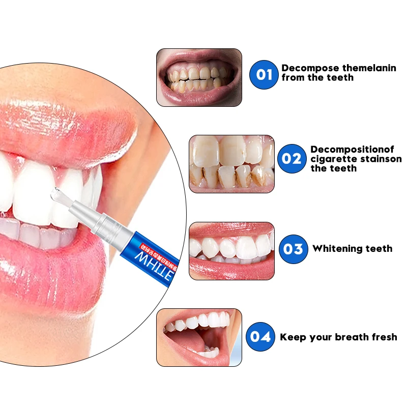 Популярный гель(ручка) для отбеливания зубов, отбеливание, удаление Красители гигиена полости рта, горячая Распродажа