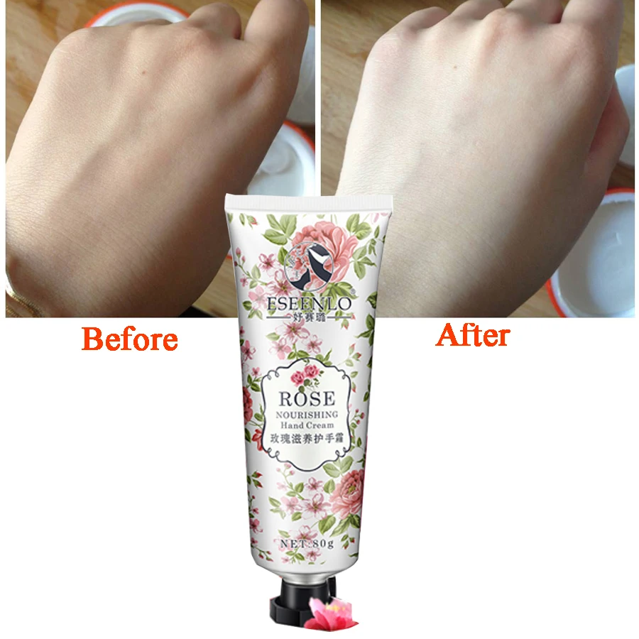 anti wrinkle cream for hands