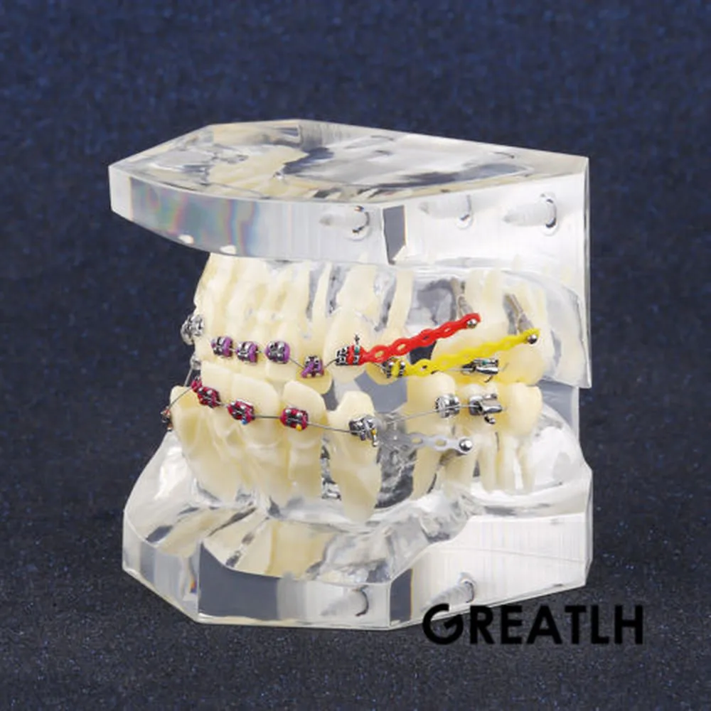 

1PC Dental Orthodontic Study Model Transparent Teeth Malocclusion Orthodontic Model With Colorful Brackets&Hot Sale for Teaching