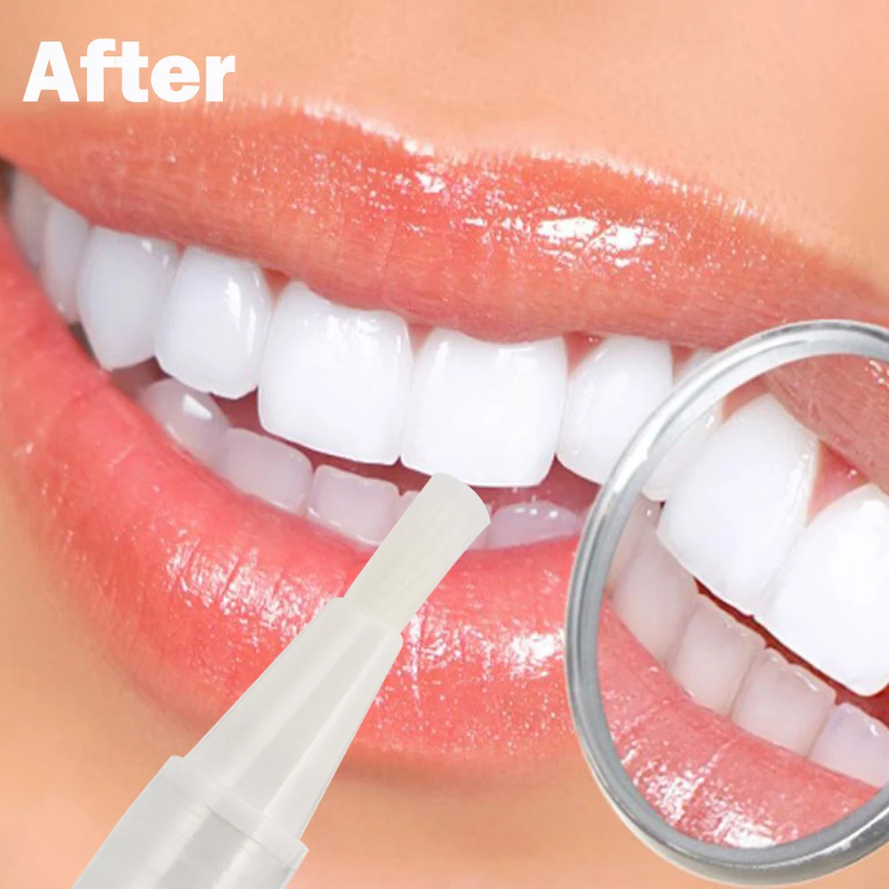 

1pc Oral Hygiene Effective Teeth Whitening Pen Tooth Gel Whitener Tooth Whitening Bleach Remove Stains White Brighten Teeth