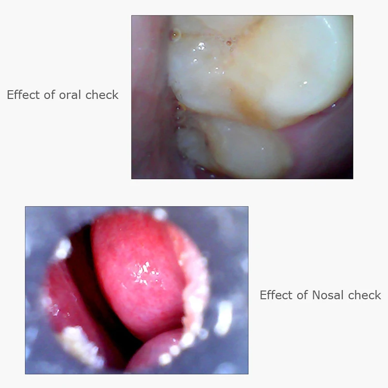 4,9 мм объектив медицинский USB ушной нос Зуб Уход за ушами эндоскоп OTG Android телефон ПК бороскоп осмотр отоскоп эндоскоп камера
