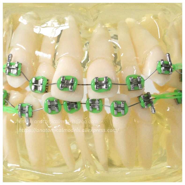 13023 DH202-1 Orthodontic Model ,cmam anatomical model 