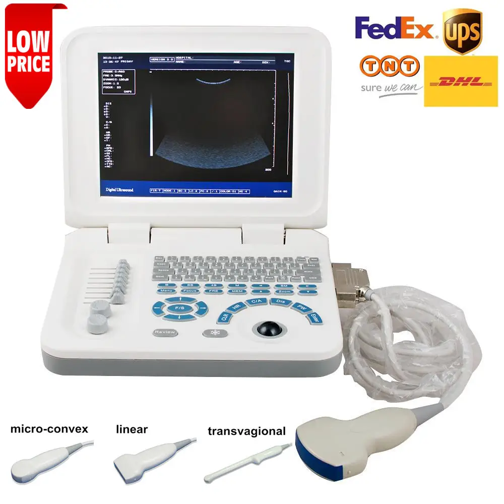 

10 in LED screen portable ultrasound free shipping