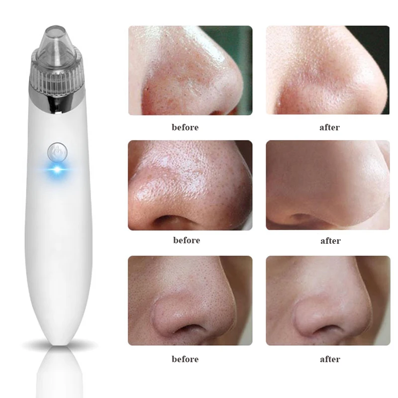 Electric USB Charge Vacuum Blackhead Removal Acne Blemish Remover