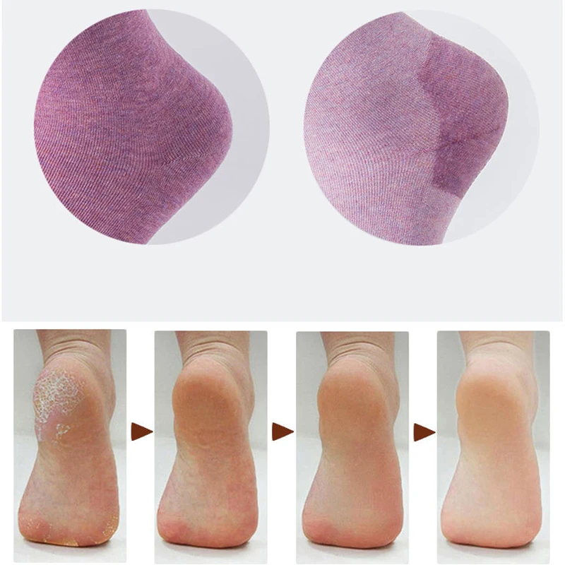 1 пара силиконовых гелевых носков для пятки увлажняющая защита от образования трещин для ног сухая зимняя защита кожи педикюрные носки инструмент для ухода за ногами TSLM2