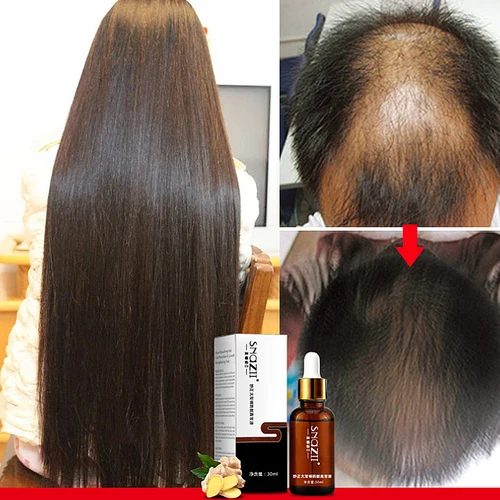 Hair Serum Growth Serum Healthier Nourishing Essences for Hair Care Oil Healthy Firm Hair Treatment Product Strengthen Hair Root Pakistan