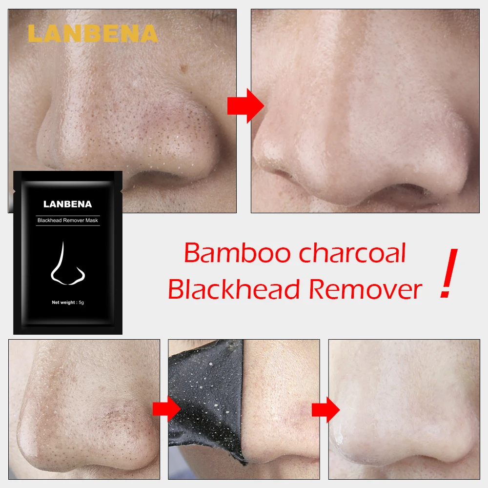 LANBENA, маска для удаления черных точек, маска для лица, лечение акне, пилинг, черная маска, полоска пор, маска для удаления черных точек, уход за кожей, 10 шт