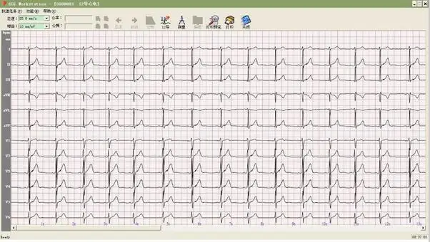 CONTEC8000G Многофункциональный ПК ECG/EKG рабочая станция система 12 свинец отдыха ECG