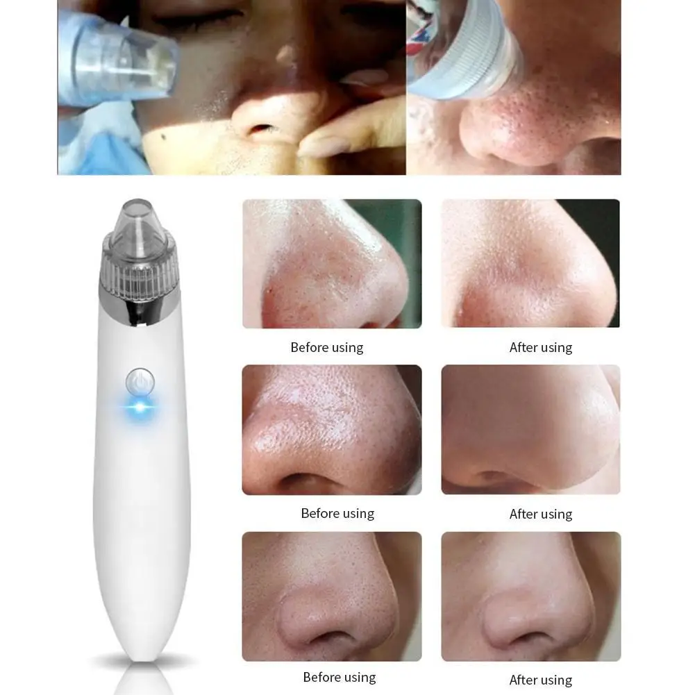 

1pcs Blackhead Removal Skin Care Machine Face Deep Electric Pore Cleaner Acne Pimple Removal Vacuum Suction Facial Beauty Tool